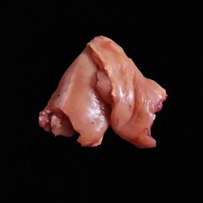 Breast
